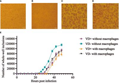 Vitamin D effects on Chlamydia trachomatis infection: a case-control and experimental study